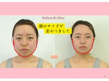 円山カラダ/顔のサイズが変わりました