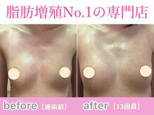 サラエクセレント 新宿(SARA EXCELLENT)の雰囲気（カウンセリングからバストアップニストにお任せ♪元祖脂肪増殖店）