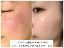 ルシェリア(le cherien)の雰囲気（その方に合った正しいケアをしてあげれば必ずお肌は変わります。）