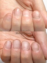 マリーロール 梅田店(Marie Laure)/自爪育成/深爪矯正/ネイルケア