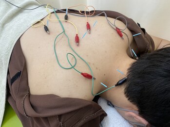かげやま鍼灸接骨院/体の鍼