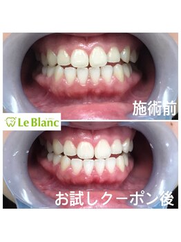 ルブラン 奈良店(Le Blanc)/格安クーポンで