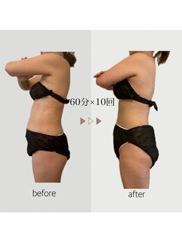 ファミーユ 名古屋店/【体質ケア】更年期/自律神経