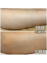 シンバ 倉敷店(SIMBA)/