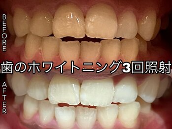 ヴィオール 名古屋栄店(VIOR)/研磨剤不使用！