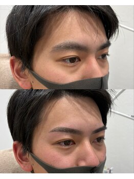 ヒカリス ナカザキ(HIKARIS Nakazaki)/メンズブロウ(before・after)