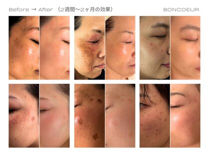 ボンクール(BONCOEUR)の写真