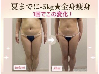 サイエス 八代(SAIs)/
