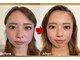 グレースフィオーレ 横浜店(gracefiore)の写真