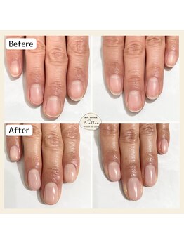 自爪育成　再来