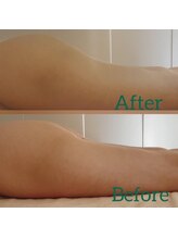 ホットナンバー(HOT number)/フェムケアしながら全身ケアして