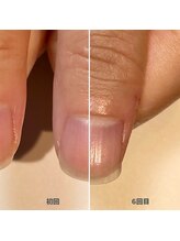 ココデネイル(cocode nail)/爪が薄い・形が悪い