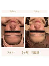 ガムラン(Gamelan)/フォト＋　6ヶ月（4回目)