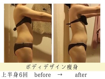 ボディデザインホームクレアフェリーチェ 神戸(Body design home Crea felice)/ボディデザイン痩身・上半身