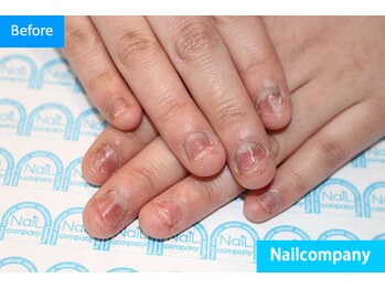 ネイルカンパニー/