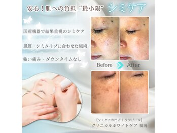 クリニカルホワイトケア 福岡店(クリニカルWHITEケア)