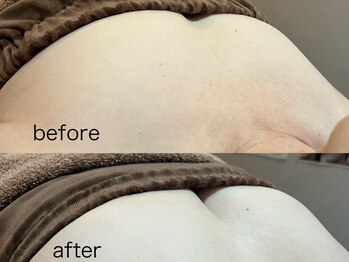 サロンズ ホット スパ ラニ(SALON'S HOT SPA Lani)/施術風景