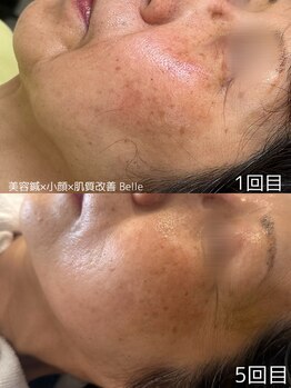 ベル(Belle)/年齢肌のお悩みをトータルケア