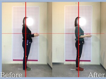 トロ整骨院(toro整骨院)/骨格矯正24回★30代女性
