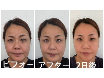 アクアナチュラ(ACQUANATURA)/左右差が無くなりむくみスッキリ