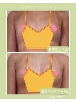 アイン 銀座(Ain)/バストアップ例３ ブラなし谷間