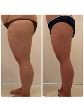 美人バスト 浜松店/【バストを残してダイエット★】