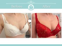 美人バスト 那覇店/バストアップ・育乳◆症例◆
