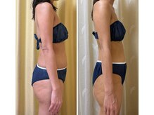 エイチラボ(H lab.)の雰囲気（体に負担をかけない独自メソッドで、整えて引き締める！【痩身】）