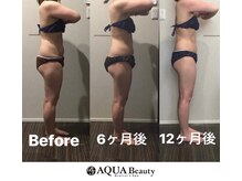 ビーエスアクアビューティー/ボディ徹底部分＋全身流し