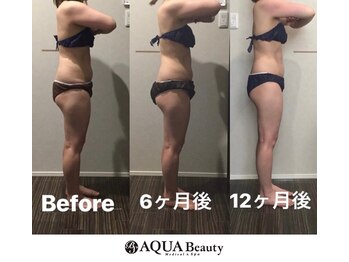 ビーエスアクアビューティー/ボディ徹底部分＋全身流し