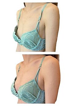 アンド ユー(and.yu)/30代/ブライダル