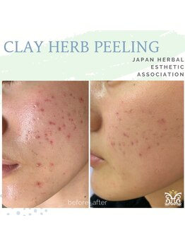 スリジエ ボーテ(cerisierBEAUTE)/何しても改善されないお悩みも!