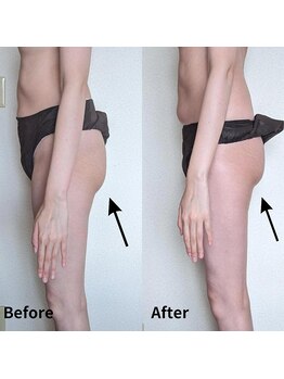 サロン ド ベルメール(Salon de Belle mer)/リンパマッサージ/痩身/リンパ