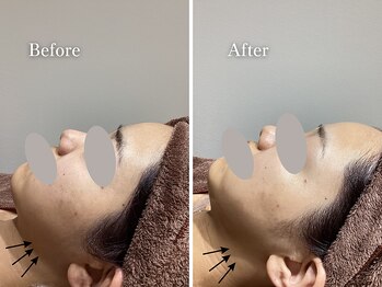 エリー(Ellie)/結婚式前直前1回プラン♪