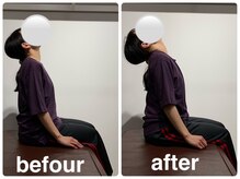 はぴねす鍼灸整骨院 飯田橋サクラテラス院の雰囲気（姿勢矯正・骨盤矯正で圧倒的な変化を体感♪）