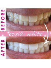 エクシアホワイト 倉吉店(ecxia white)/ビフォーアフター