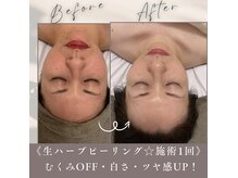エッセンシア(ESSENCIA)の雰囲気（剥離なし◎肌に優しいハーブピール！国産ハーブ100%使用♪）