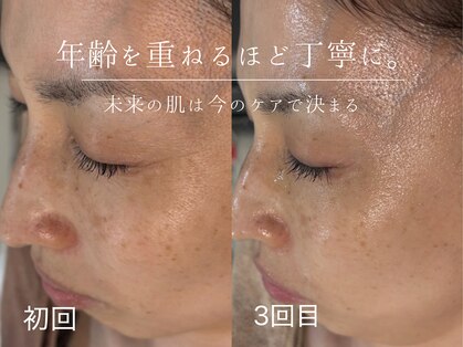 ウィハナ(wehana)の写真