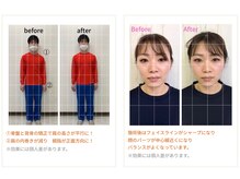 J'Sメディカル整体院 栄院の雰囲気(姿勢改善・小顔矯正コース身体だけでなくお顔も是非体験を!)