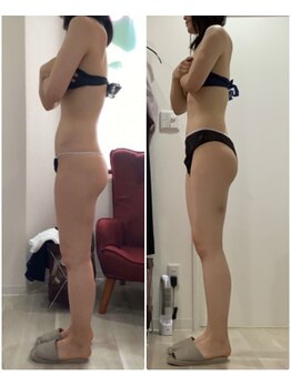 プラチナアース つくば店(Platinum earth)/痩身ビフォーアフター