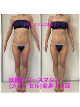 セルビューティー(Cell Beauty)/30代、筋膜リリース全身10回