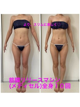 セルビューティー(Cell Beauty)/30代、筋膜リリース全身10回