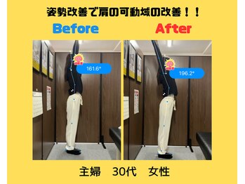 ナオル整体 本厚木院(NAORU)/姿勢矯正で肩の可動域UP！！