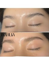 ダリア(Dahlia)/眉毛のワックス脱毛