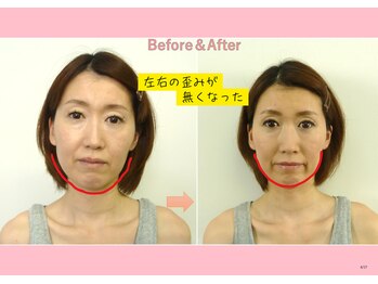 円山カラダ/左右の歪みがなくなりました