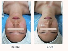 りりあす/不安定な肌を健康的な肌へ☆