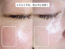 アンシャンテ 神戸元町店(Enchante)/毛穴洗浄ピーリングフェイシャル