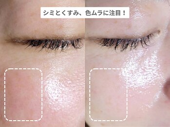 アンシャンテ 神戸元町店(Enchante)/毛穴洗浄ピーリングフェイシャル