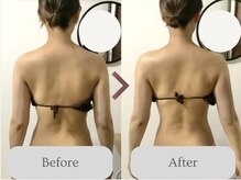 効果絶大◎パワーレメディ【疲労改善・姿勢改善・痩身】