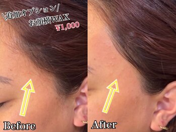 ジョエルワックス 沖縄那覇店(JOELLE WAX)/お顔横美人★部分WAX脱毛！！